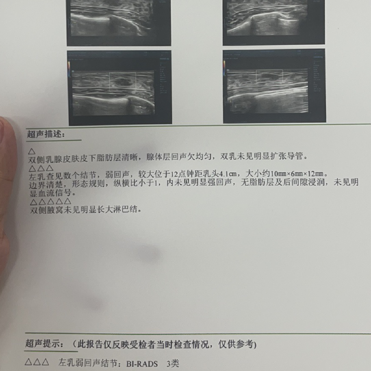 乳腺健康解讀