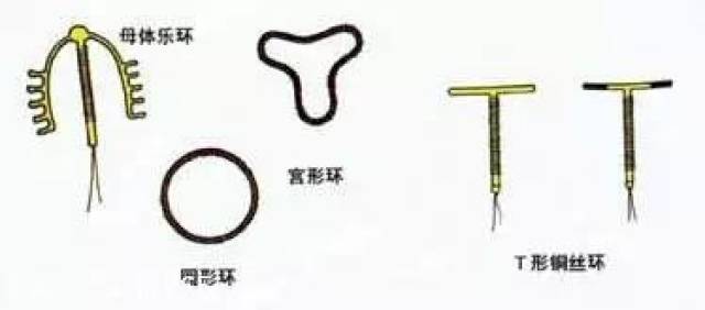 避孕環(huán)