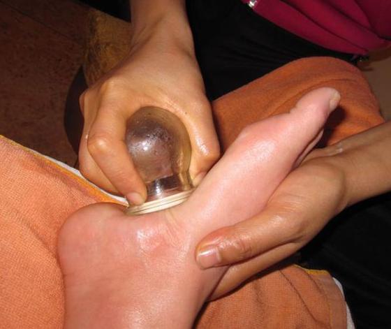 拔火罐對腎虛有好處嗎？深度解析傳統(tǒng)療法與現代健康理念，拔火罐對腎虛的益處解析，傳統(tǒng)療法與現代健康理念融合探索