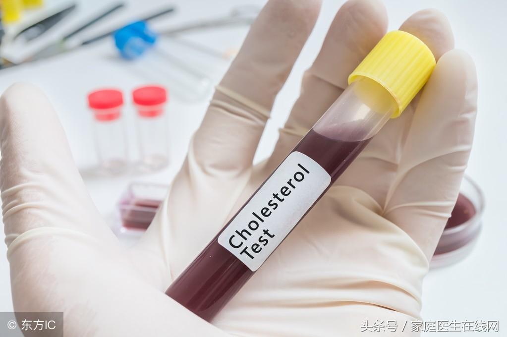糖尿病的成因，深度解析其背后的原因，深度解析糖尿病成因，揭示背后原因真相